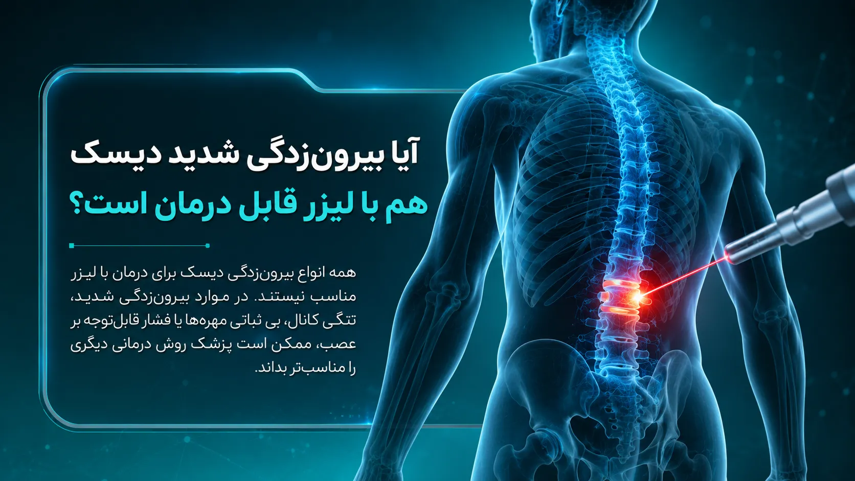عمل لیزر دیسک کمر
